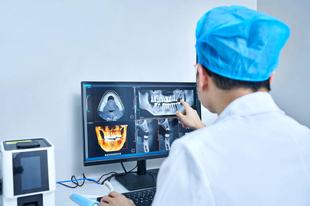 Best Emergency Tooth Extraction in Spring Park, MN